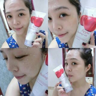 Tẩy tế bào chết