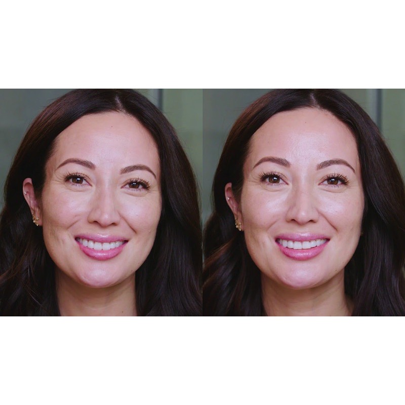 🌸 Kem làm giảm nhăn vùng mắt Shiseido Befeniance Wrinkle Smoothing Eye Cream minisize