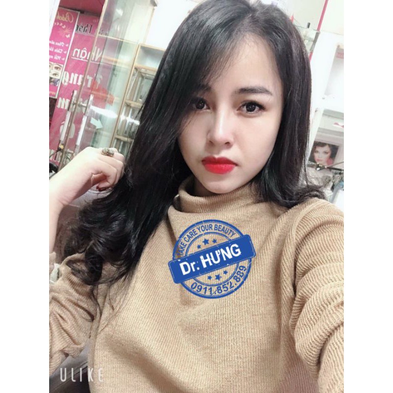 - Nâng mũi sụn Softxil