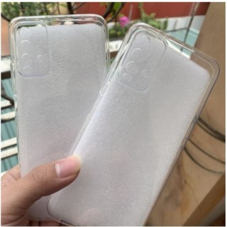 Ôp lưng dẻo Xiaomi Redmi Note 10 /redmi Note 10 pro trong suốt