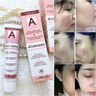 Kem Achromin giảm nám và tàn nhang