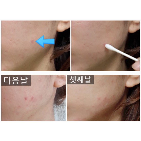 Tinh Dầu Tràm Trà Chấm Mụn Some By Mi 30 Days Miracle Tea Tree Clear Spot Oil 10ml