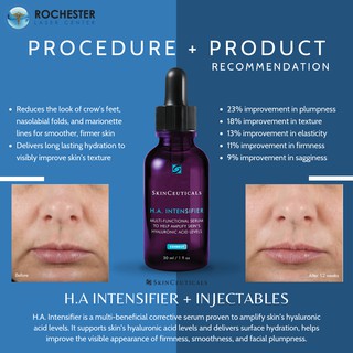 [Bản Mỹ] Serum cấp nước SkinCeuticals HA Intensifier