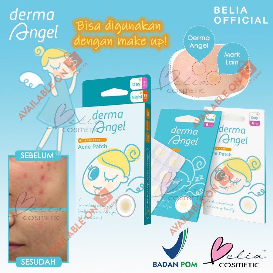 ❤ Belia ❤ Derma ANGEL (✔️Miếng dán trị mụn ngày và đêm tiện dụng | Tấm thạch cao trong suốt trị mụn | Gel tăng cường