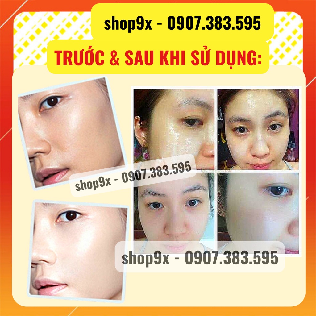 Xà Phòng Nghệ Và Cám Gạo Cao Cấp Sáng Da Ngừa Mụn Cho Mặt Và Body