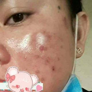 Thuốc bắc tái tạo da