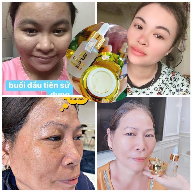 Combo kem face lụa bamboo+serum tái sinh da Mẫu mới 8- 2023