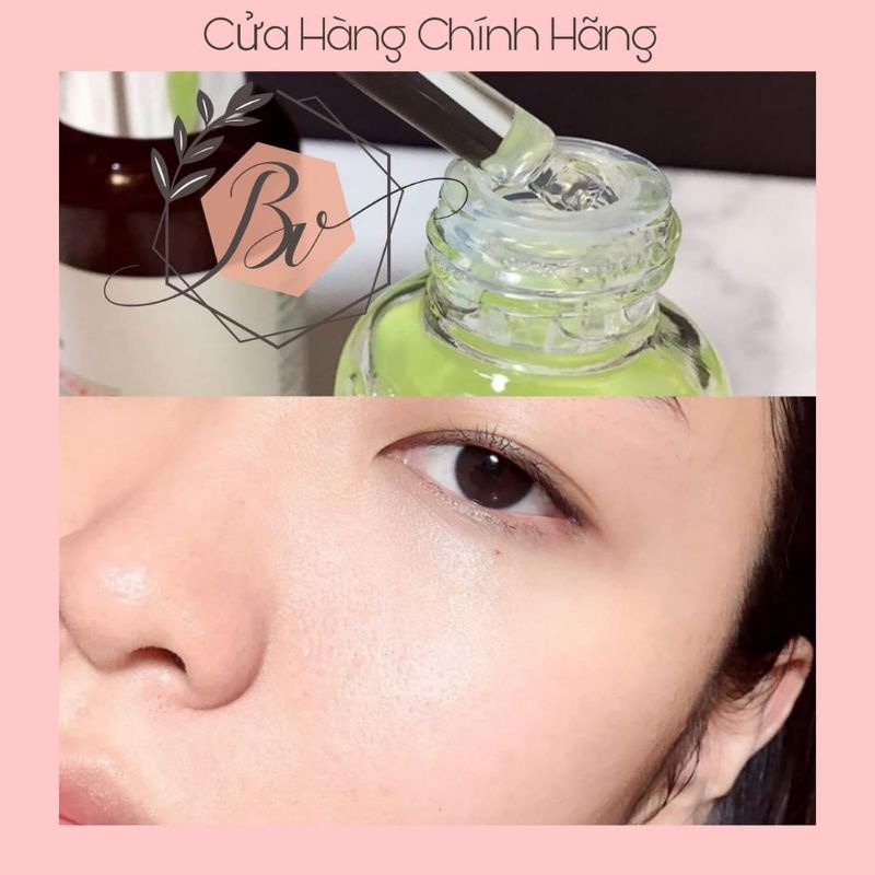 Tẩy da chết mặt cho da mụn hóa học Peeling amplen