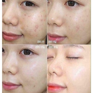 Tinh chất dưỡng da rau má CENTELLA 55ml [ chính hãng]