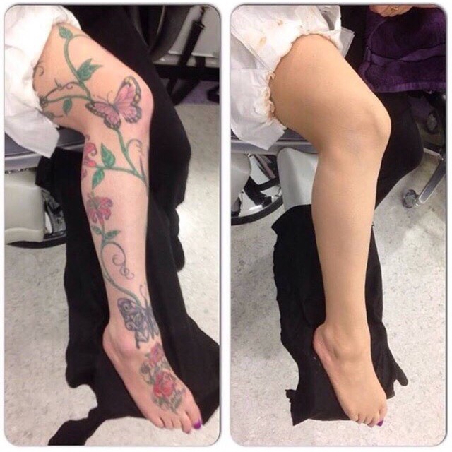 (Hàng Chính Hãng) Kem nền che KHUYẾT ĐIỂM che HÌNH XĂM Dermacol Make-up Cover 30g | BigBuy360 - bigbuy360.vn