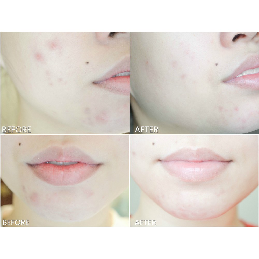 Tinh Chất Cung Cấp Vitamin, Tái Tạo Và Ngăn Ngừa Lão Hóa Da 9 Wishes Mega Vitamin Ampule Serum 25ml