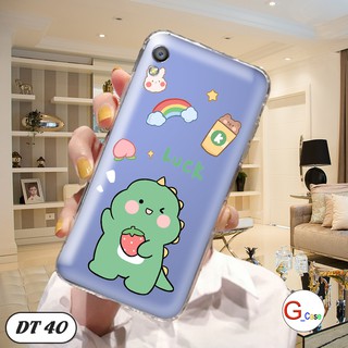Ốp lưng dẻo cho OPPO F1 Plus/ R9