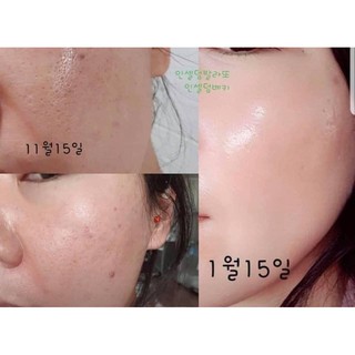 [AUTHENTIC] Set Dưỡng Da Căng Bóng, Trẻ Hóa Da Incellderm