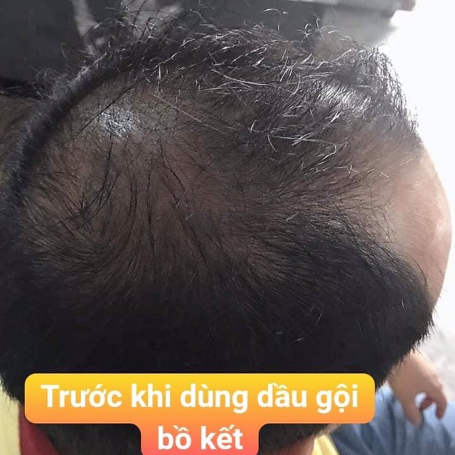 Dầu gội bồ kết hoa bưởi gàu-rụng tóc | BigBuy360 - bigbuy360.vn