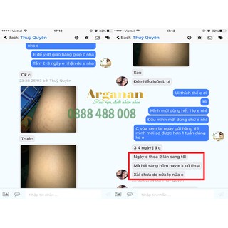 Combo 2 hộp trị rạn Arganan