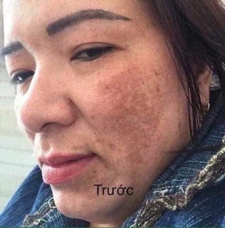 Bộ Meiya cam của Nhật