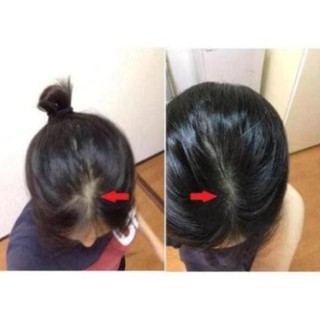Thuốc bôi kich thích mọc tóc sato Nhật Bản