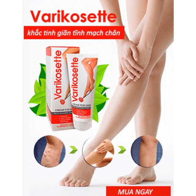 Varikosette – chữa suy giảm tĩnh mạch Nga