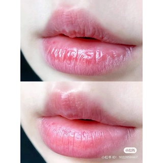 Mặt nạ môi Prreti Real Vita Hydrogel Lip Patch