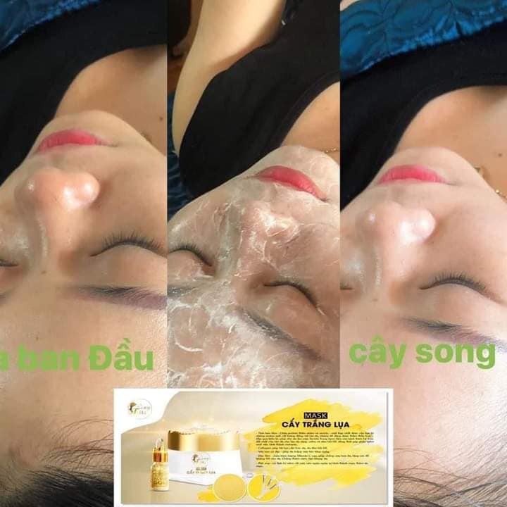 Cấy trắng lụa tặng kèm lọ dưỡng collagen
