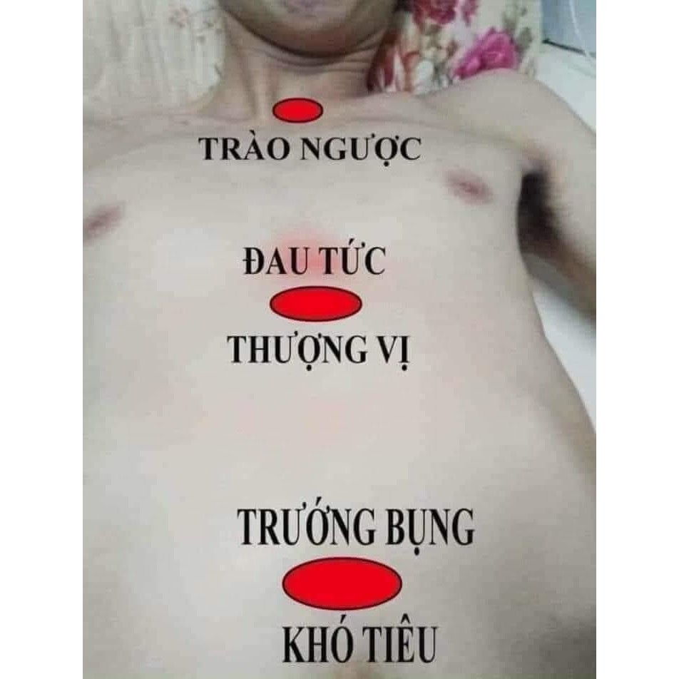 Yamungel - Bảo Vệ Niêm Mạc Dạ Dày - Trung Hòa Acid Dịch Vị
