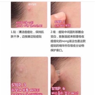 [Hàng chuẩn] [Tách Lẻ] Miếng Dán Mụn Olive Young Careplus