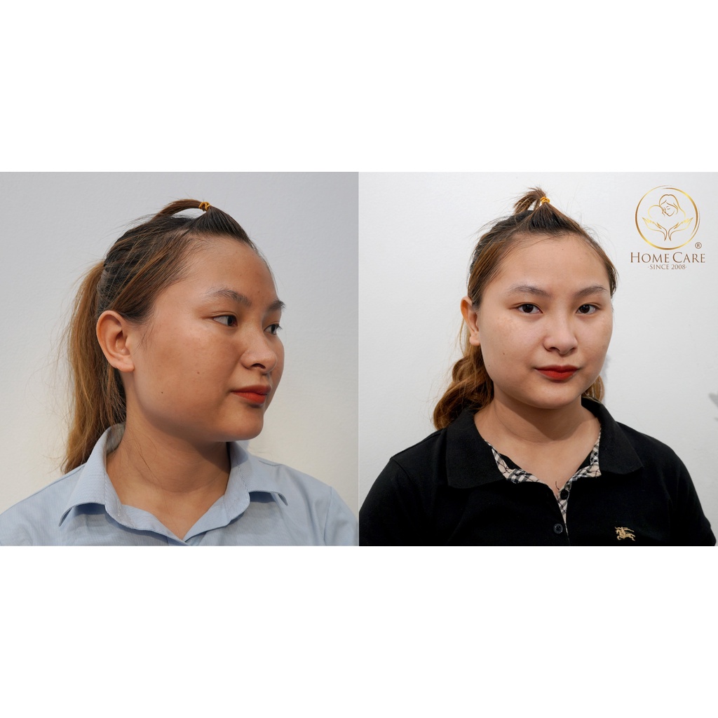 Kem ủ trắng face Phục linh nâng tone tự nhiên