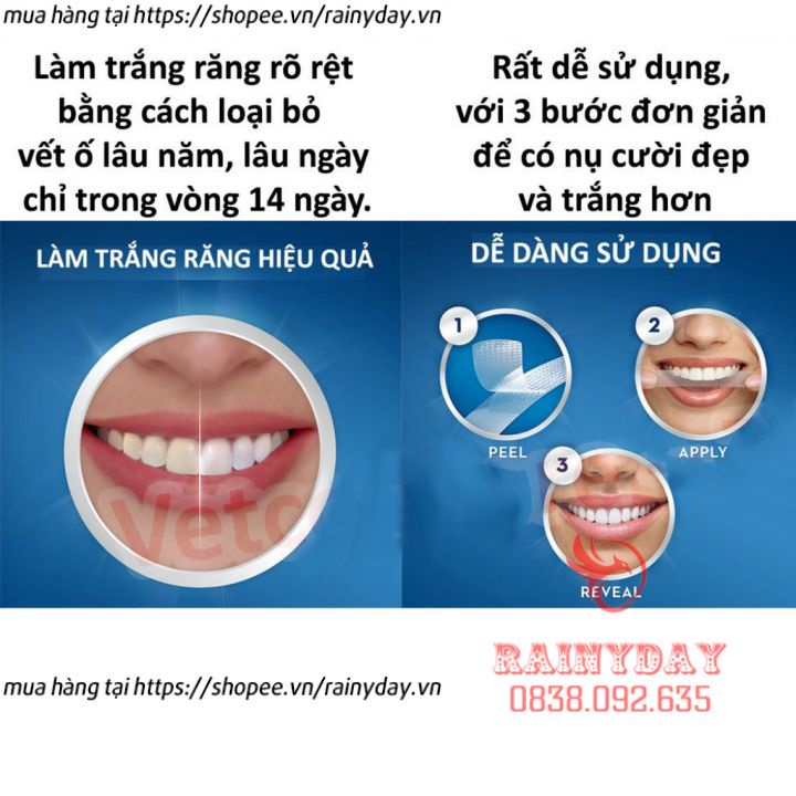 Hộp 14 miếng dán trắng răng tiện lợi 3D White Teeth Whitening Strips dán tẩy trắng răng nội địa trung