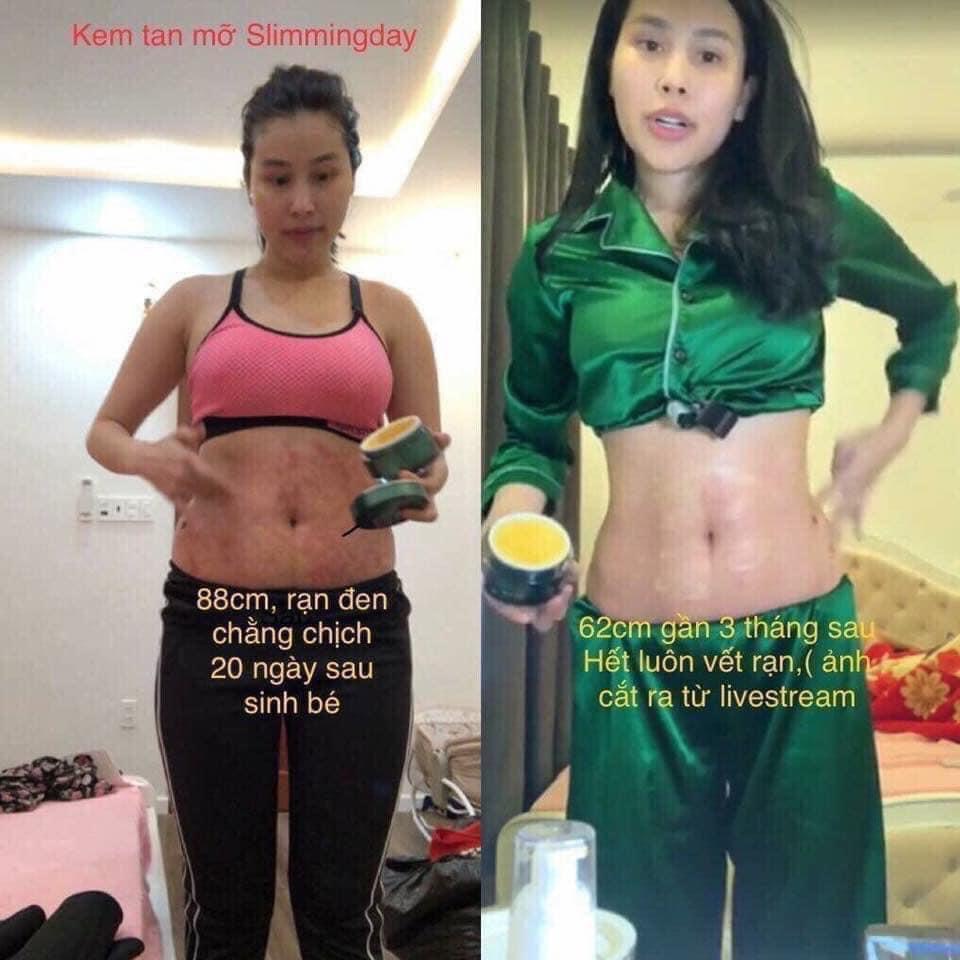 Kem Tan Mỡ Bụng Slimming Body Slimming Day Collagen Và Đai Nịt Bụng Amy Sline
