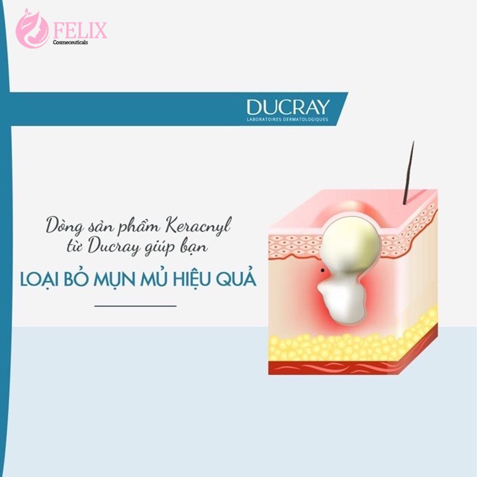 [NHẬP KHẨU] Kem hỗ trợ giảm mụn trứng cá DUCRAY Keracnyl PP Anti-Blemish Soothing Cream Ducray 30ml