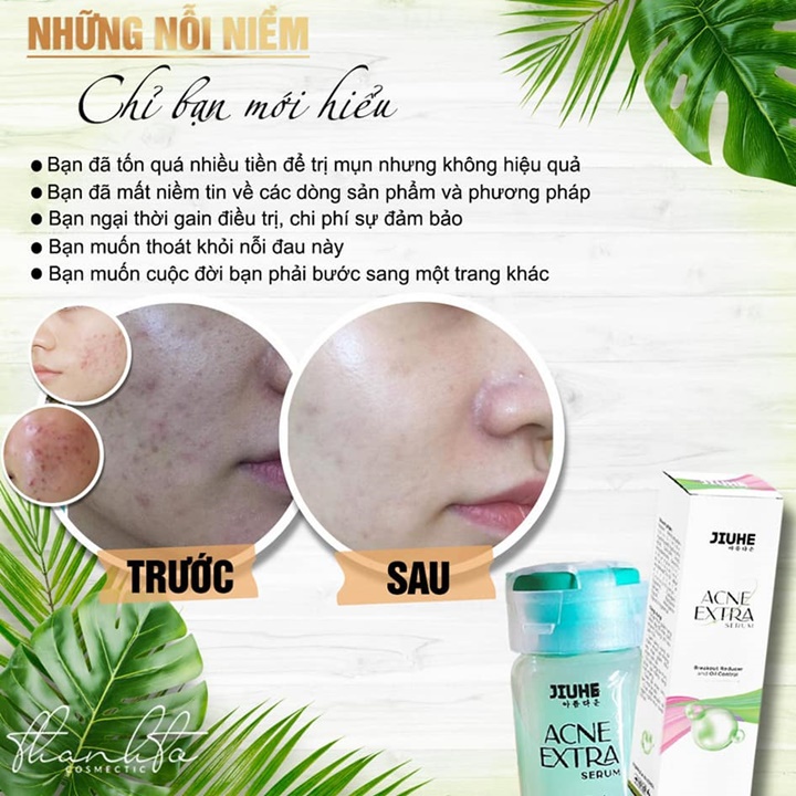 Serum dưỡng da mụn Acne Extra Jiuhe mới – ACL534