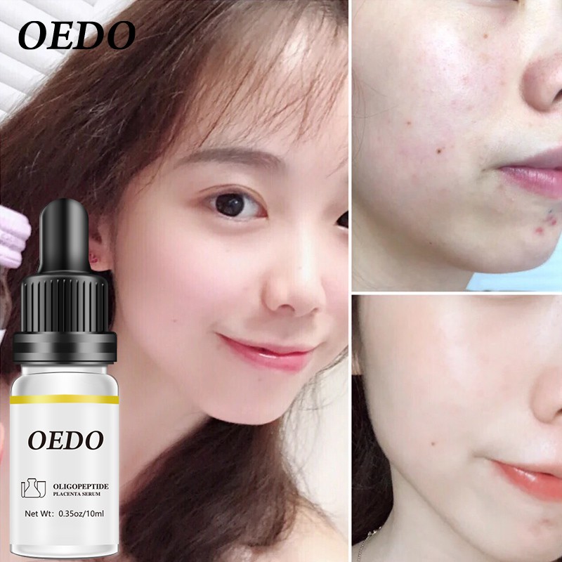 OEDO Serum dưỡng da Oligopeptide Placenta giữ ẩm phục hồi trắng chống lão hóa và nếp nhăn