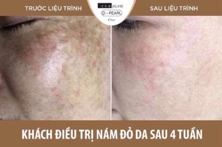Kem dưỡng da Q – Pearl
