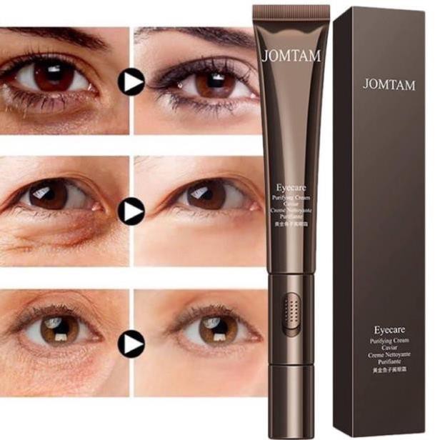 Kem Dưỡng Mắt Tích Hợp Máy Rung Massage JOMTAM Giảm Quầng Thâm Bọng Mắt -shopforgirl | BigBuy360 - bigbuy360.vn