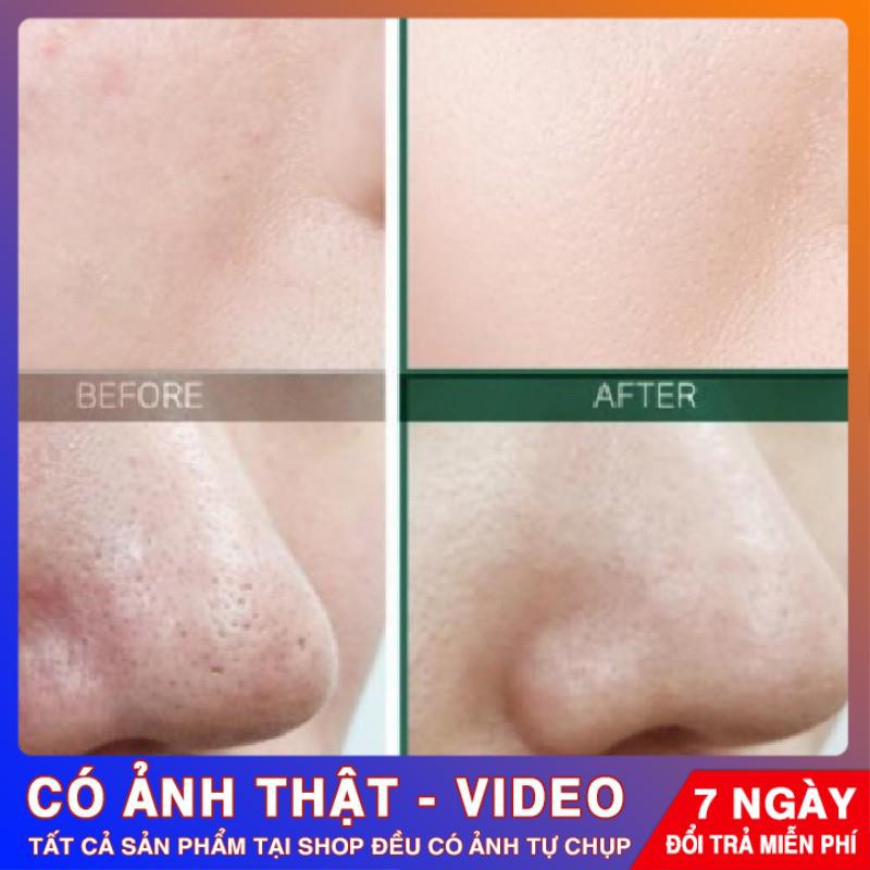 [CHÍNH HÃNG] Nước Hoa Hồng Giảm Mụn Some By Mi AHA-BHA-PHA 30 Days Miracle Toner Some By Me 150ml | BigBuy360 - bigbuy360.vn