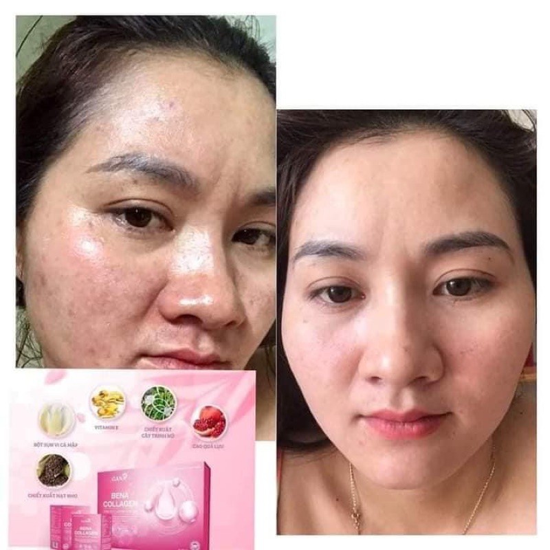 [FREESHIP] COMBO 3 hộp collagen- ngăn ngừa quá trình lão hoá | BigBuy360 - bigbuy360.vn