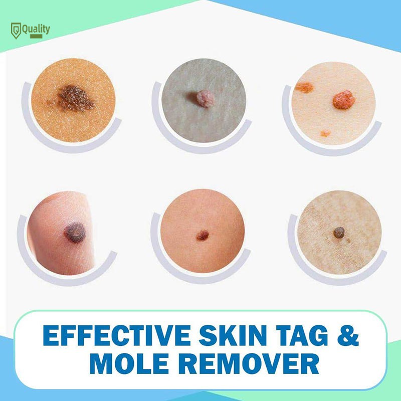 Dung dịch loại bỏ mụn thịt dư an toàn hiệu quả 13ml