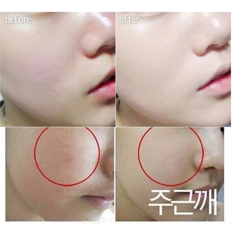 [ Nước Thần] Angel's Liquid Tone Up Whitening Program Glutathione Treatment Essence