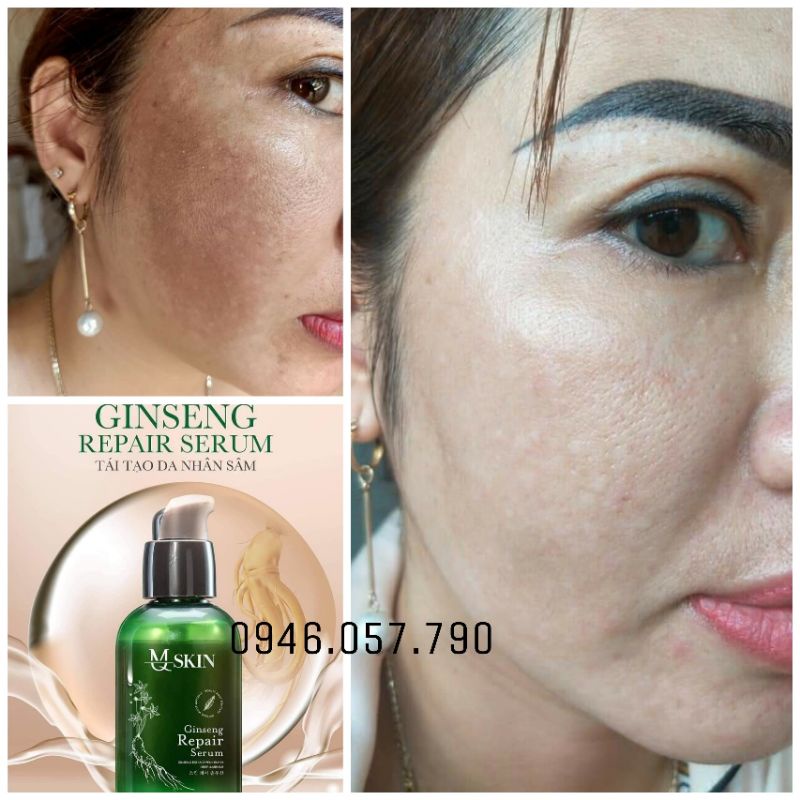Tái Tạo Da Nhân Sâm MQ SKIN