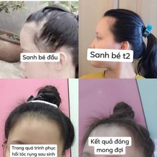 Combo tinh dầu thảo mộc(an toàn,hiệu quả)