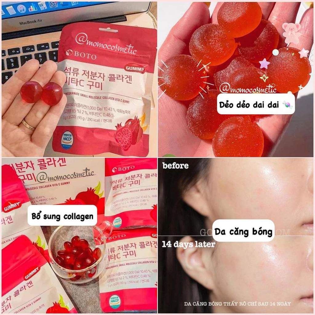 Kẹo dẻo Gummy Collagen lựu Vitamin C BOTO