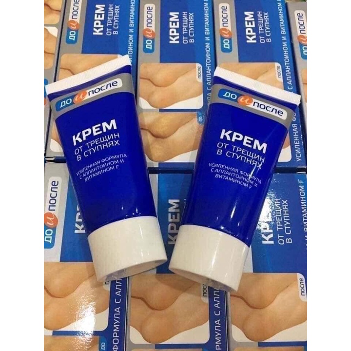 Kem bôi nẻ, nứt gót chân, dưỡng mềm mịn gót chân Kpem Nga 50ml - Nhà thuốc An Đức