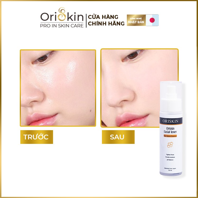 Toner Cho Da Dầu Mụn Oriskin Facial Toner 120ml, Nước Cân Bằng Da, Dưỡng Ẩm, Cân Bằng Da. | BigBuy360 - bigbuy360.vn