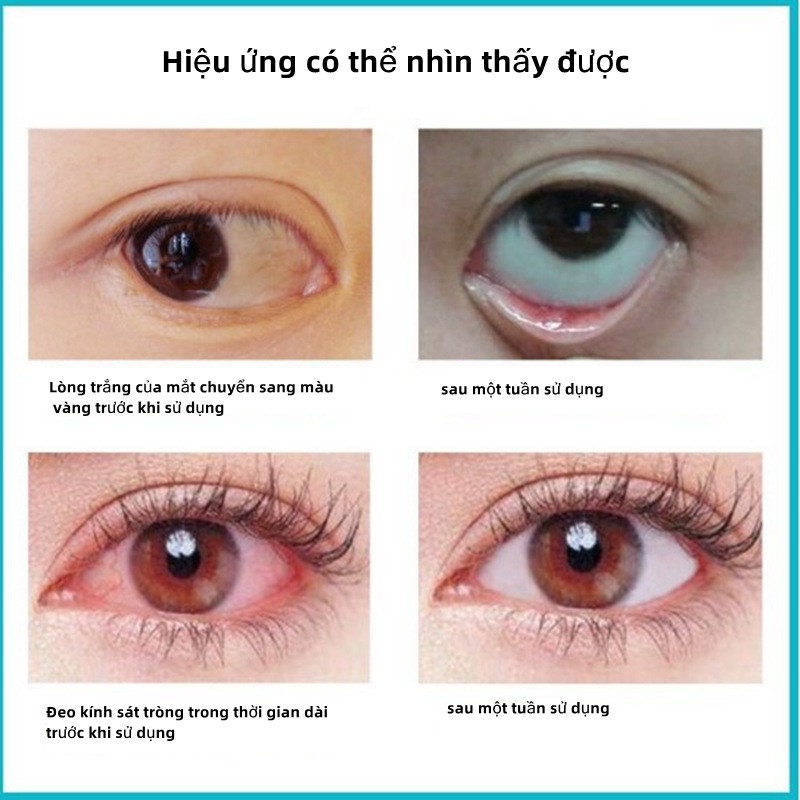 Nước rửa mắt GDTIMA Hyaluronic acid chăm sóc mắt 100ml