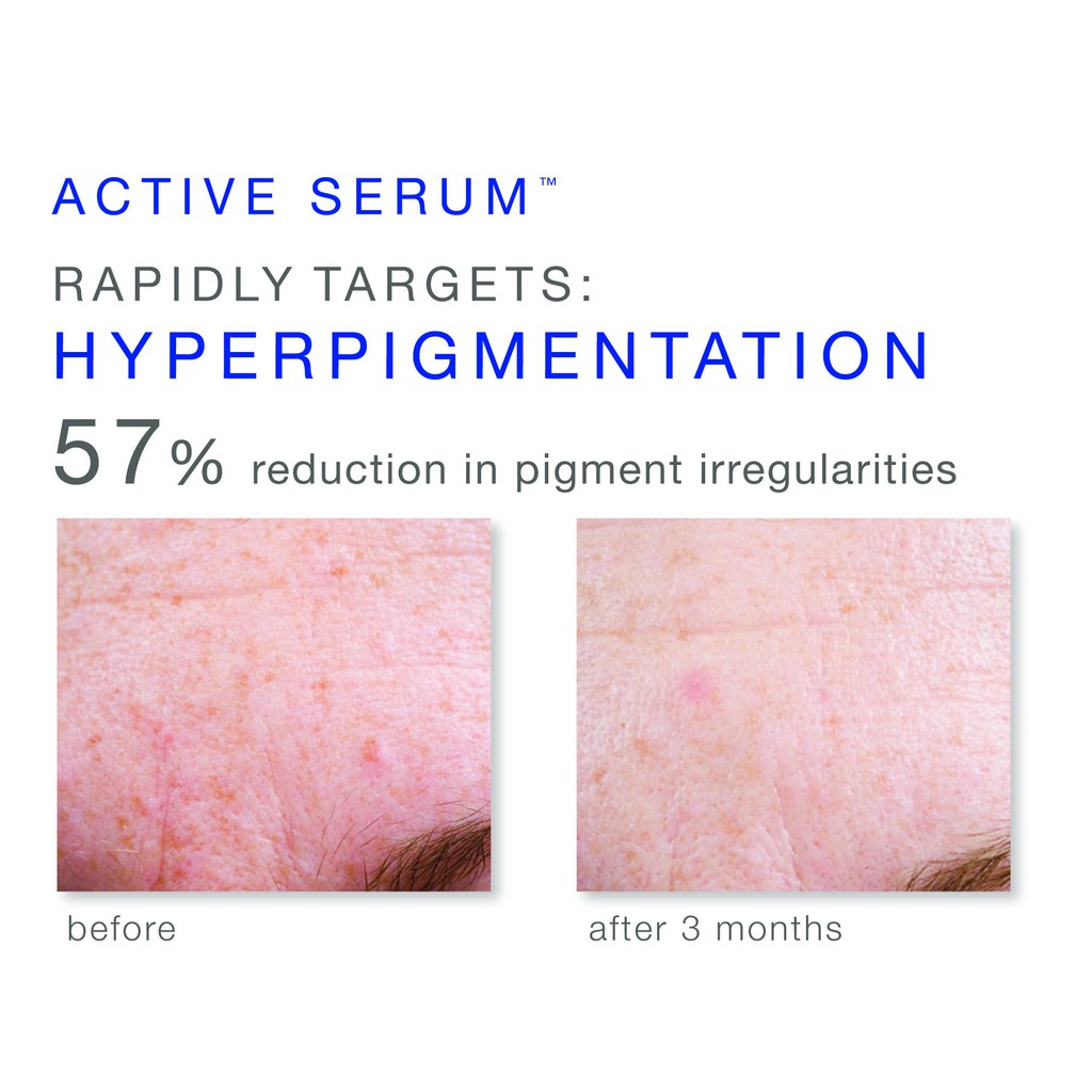 Tinh chất dưỡng da dầu mụn iS Clinical Active Serum