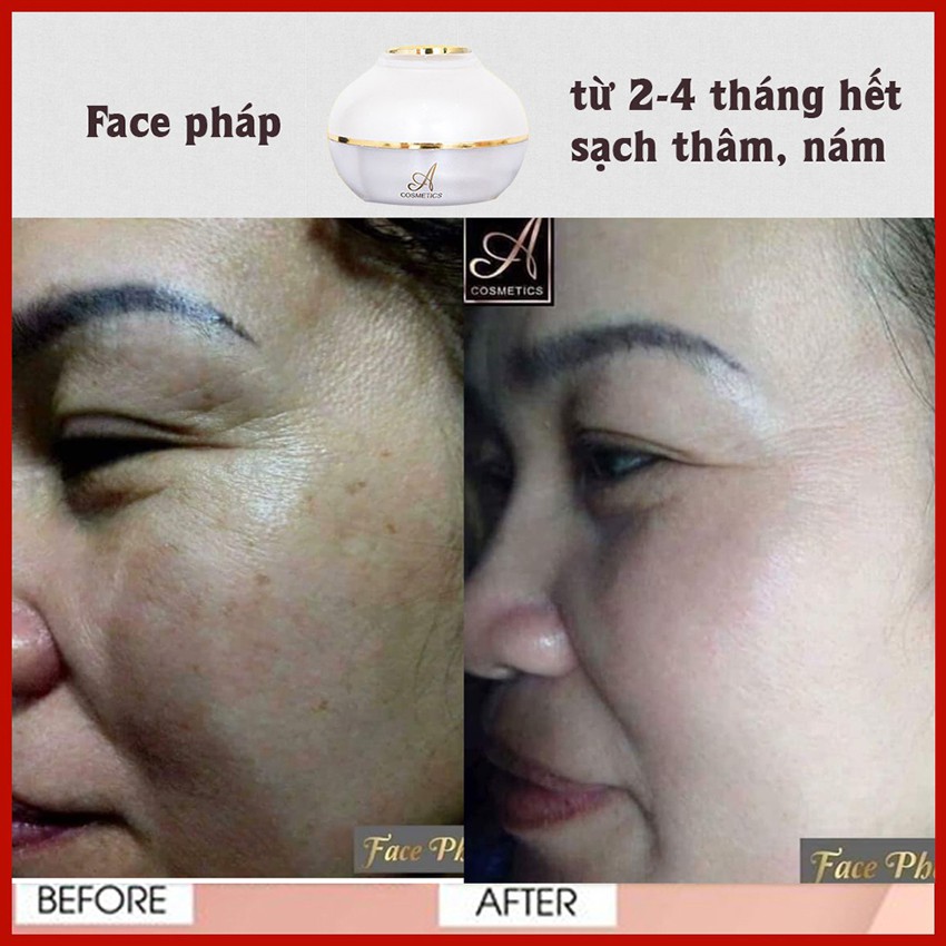 Combo Kem Face Pháp 50g + Serum 50ml - Giúp Dưỡng Trắng Da Mềm Mịn Căng Bóng | BigBuy360 - bigbuy360.vn