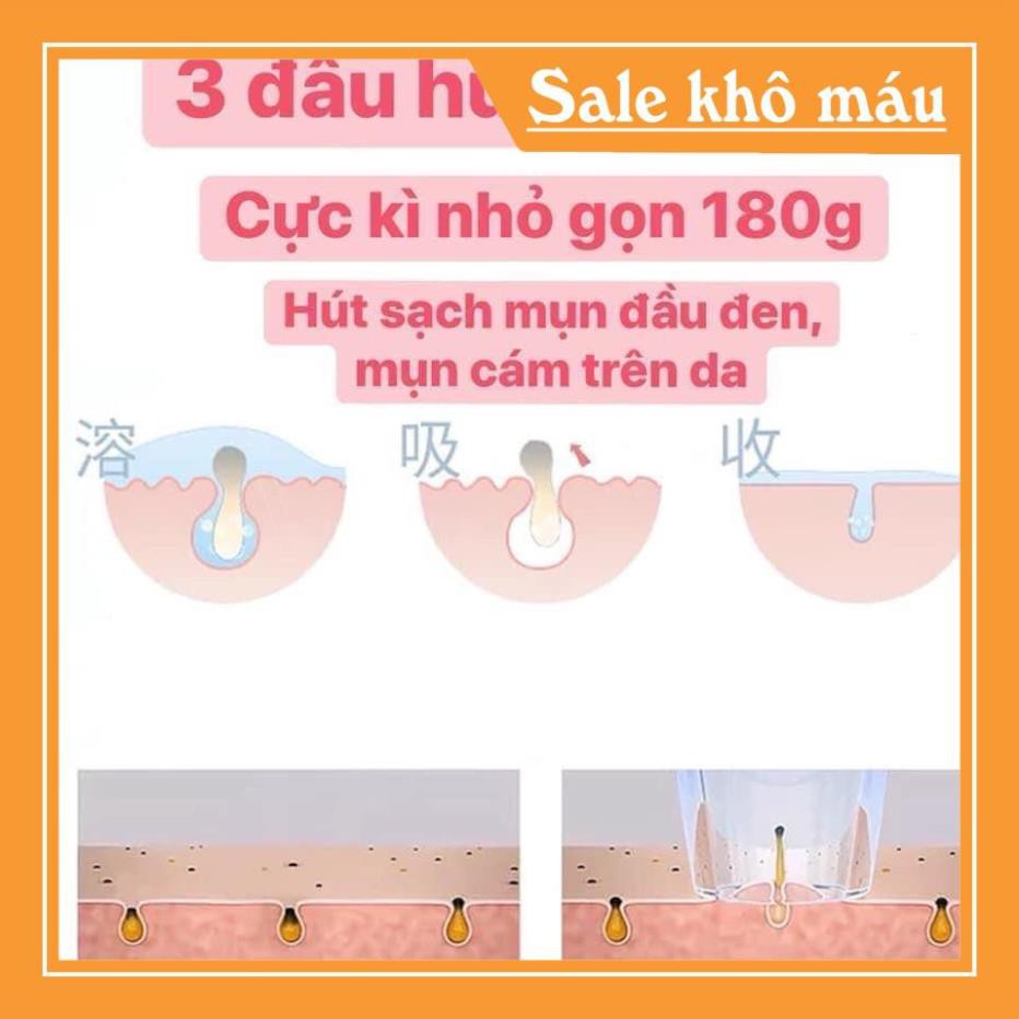 Máy hút mụn đầu đen mini cầm tay