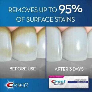 Kem Đánh Trắng Răng Crest 3D White Fluoride Anticavity Tooth-Paste