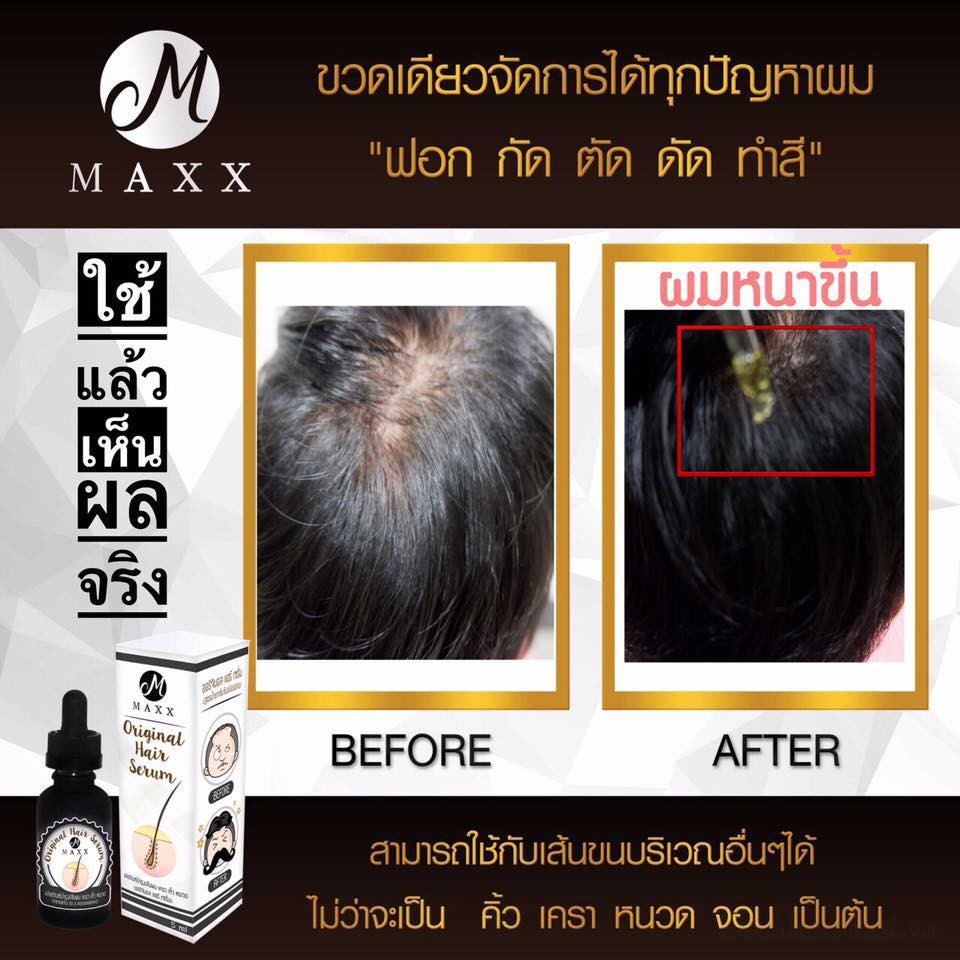 Serum ƙích nang lông Maxx Original Hair