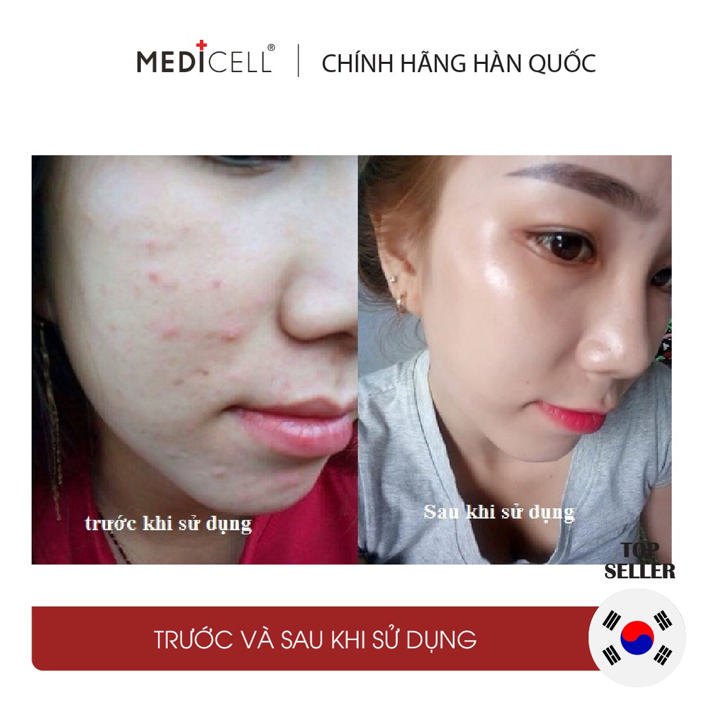 Serum tế bào gốc, kiềm dầu, cải thiện mụn, sẹo mụn, làm trắng Plantex Saffron Medicell Hàn Quốc -1 lọ